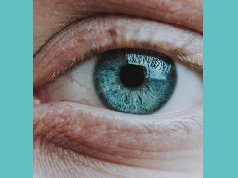 ojo humano que presenta sequedad