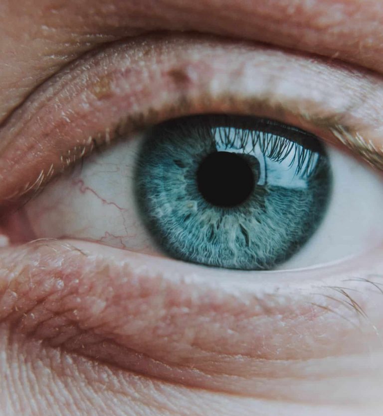 ojo humano que presenta sequedad