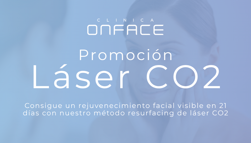 Tarjeta Láser CO2 - ok